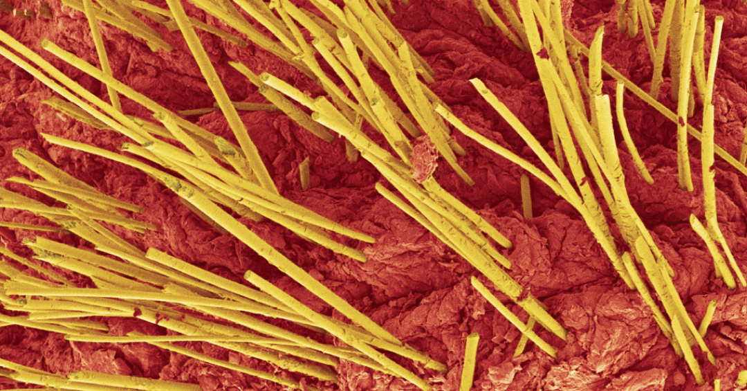 Cabelos: uma floresta de fios na sua cabeça