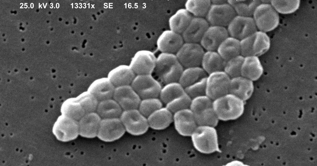 O perigo da superbactéria Acinetobacter encontrada na água de Porto Alegre