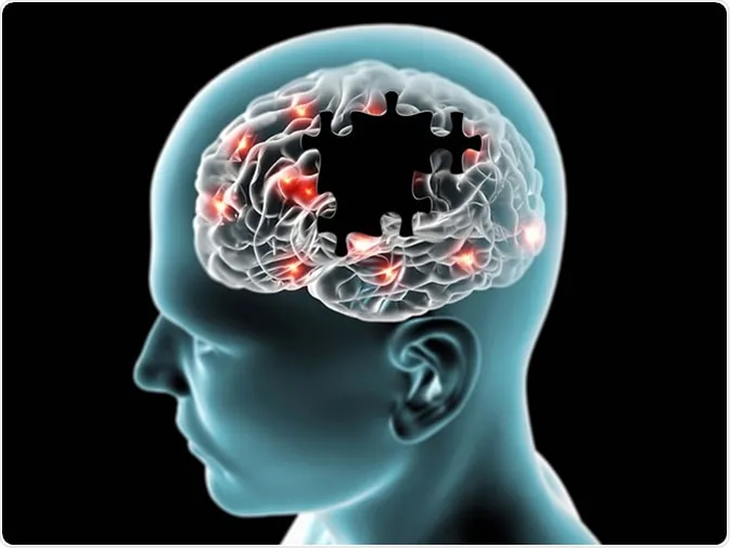 Compreendendo as Diferentes Formas de Demência Além do Alzheimer