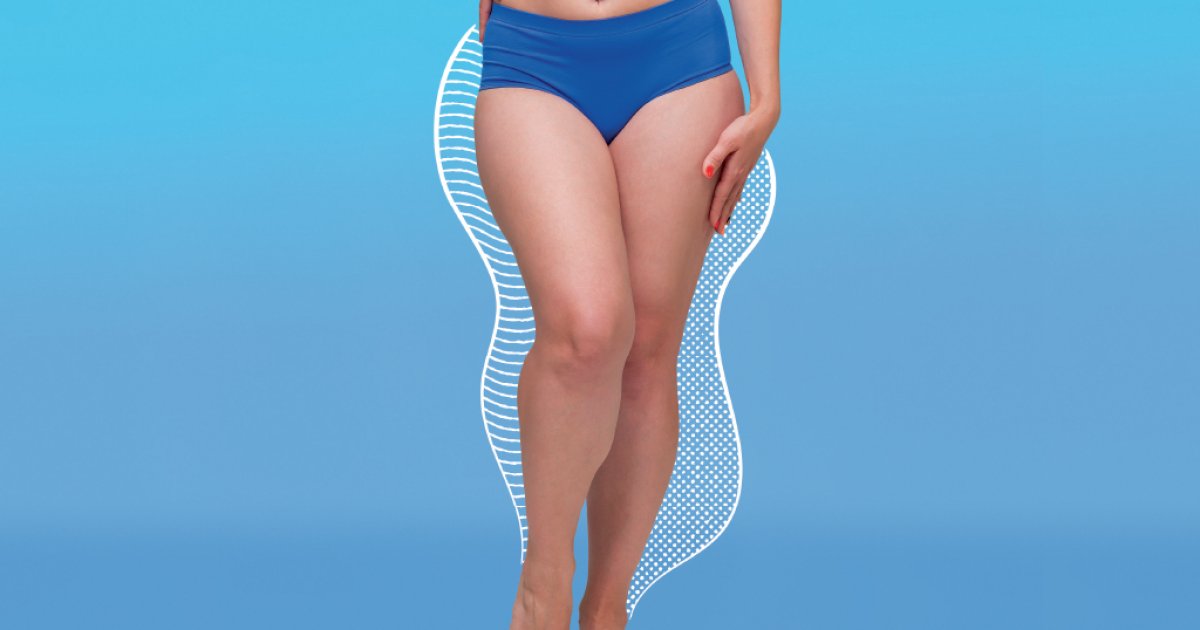 Diferenciando Celulite de Lipedema: Como Evitar Autodiagnósticos Precipitados